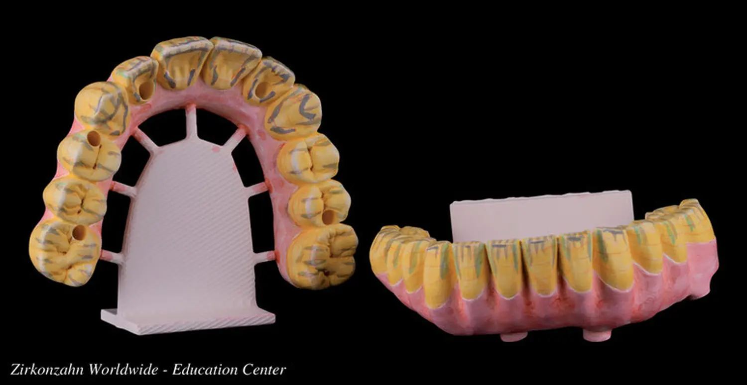 Zirkonzähne von Salza Dental GbR